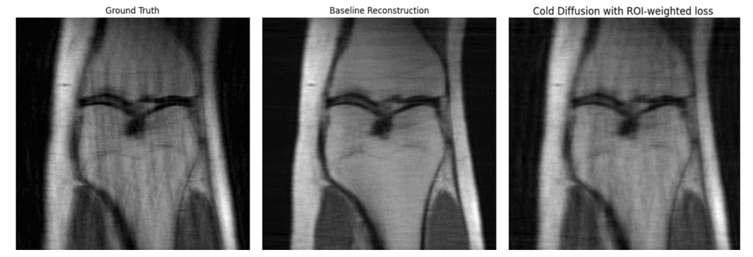 Cold Diffusion MRI Reconstruction Comparison