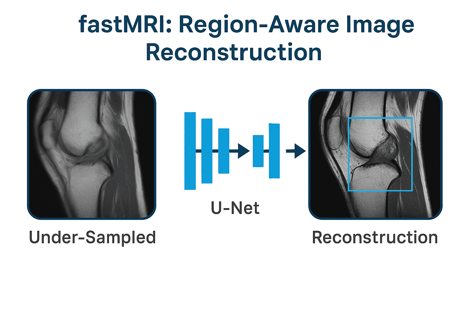 fastMRI: Region-Aware Image Reconstruction thumbnail